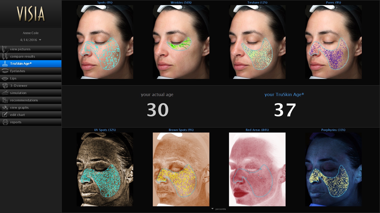 VISIA® TruSkin Age™ Analysedashboard mit vollständiger Auswertung aller Hautzonen